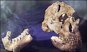 Early hominid skull and jaw
