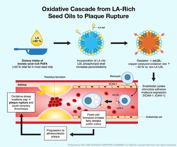 oxidative cascade from la rich seed oils plaque rupture